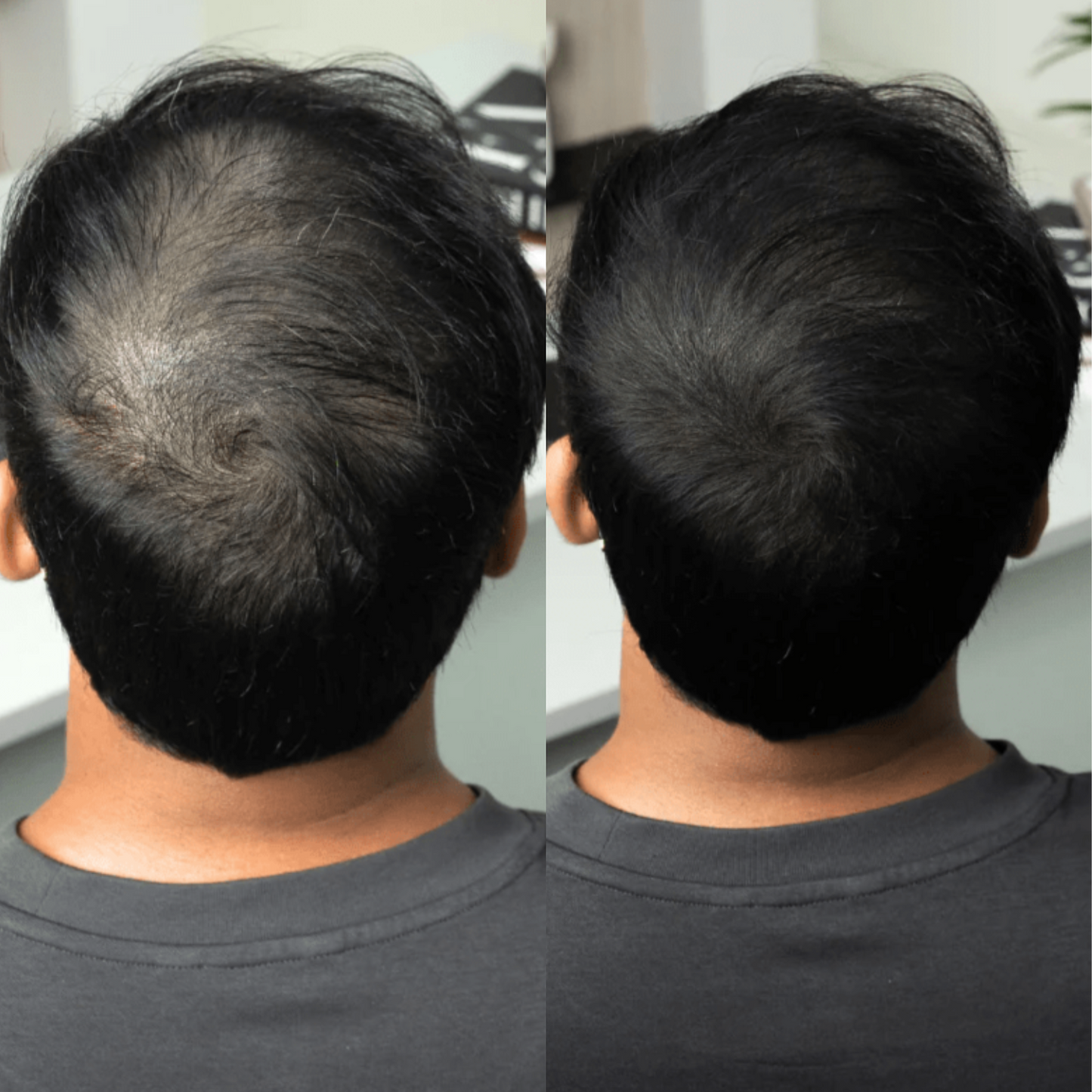 Volures™ Hair-Filling Powder No. 1 – For Men
