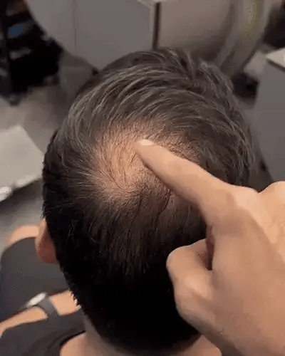 Volures™ Hair-Filling Powder No. 1 – For Men