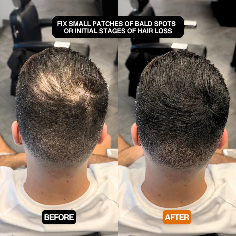 Volures™ Hair-Filling Powder No. 1 – For Men