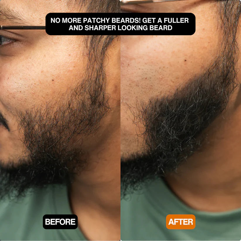 Volures™ Hair-Filling Powder No. 1 – For Men