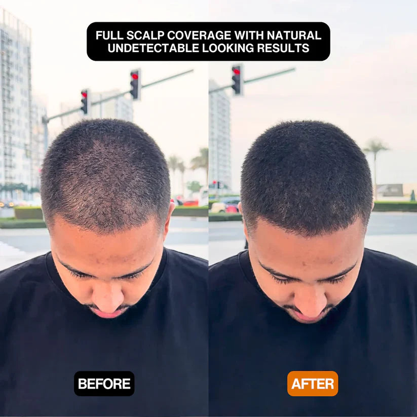 Volures™ Hair-Filling Powder No. 1 – For Men