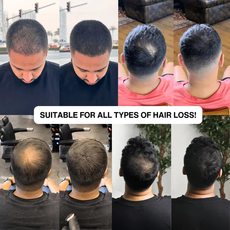 Volures™ Hair-Filling Powder No. 1 – For Men