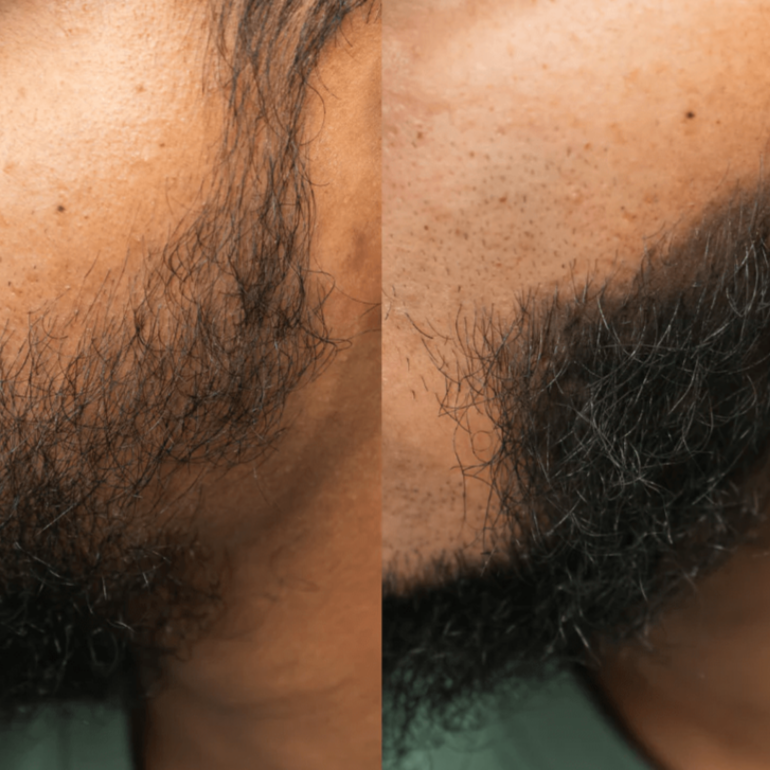 Volures™ Hair Volume Powder